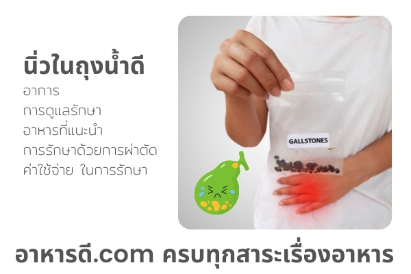 นิ่วในถุงน้ำดี อาการ และการรักษา